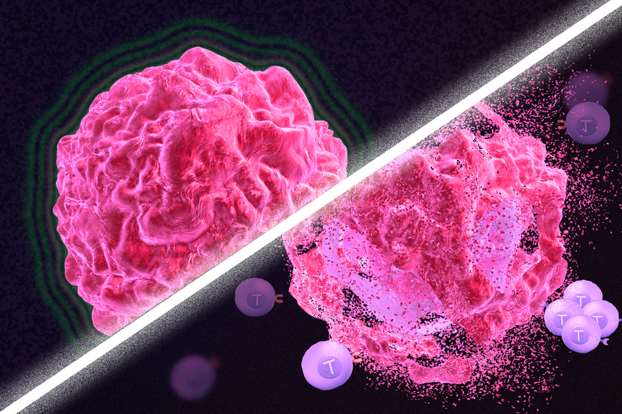 Tế bào T tấn công khối u. Ảnh minh họa.